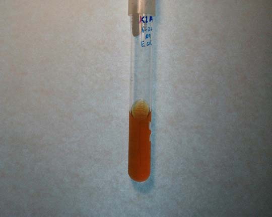 改良hodge试验阳性肠杆菌科细菌对碳青酶烯类药物的耐