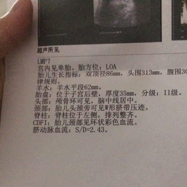 胎盘成熟度2度_胎盘成熟二级多久会生_胎盘成熟度几级才能生